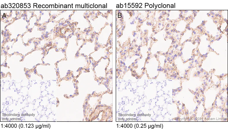 Immunohistochemistry (Formalin/PFA-fixed paraffin-embedded sections) - Anti-Fragilis antibody [RM1224] - BSA and Azide free (AB320854)