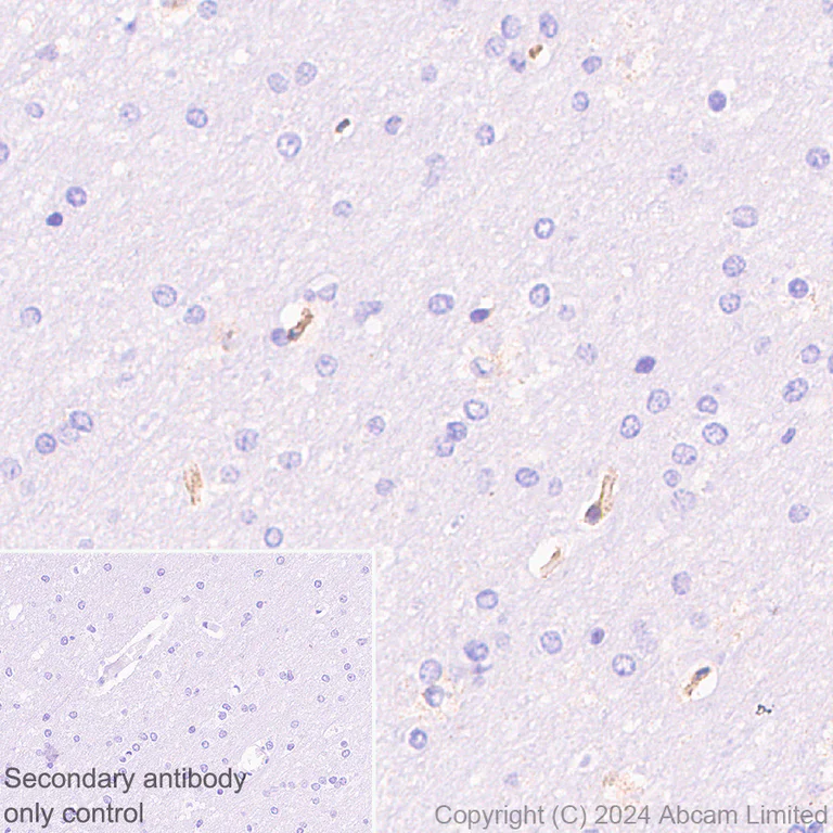 Immunohistochemistry (Formalin/PFA-fixed paraffin-embedded sections) - Anti-Fragilis antibody [RM1224] - BSA and Azide free (AB320854)