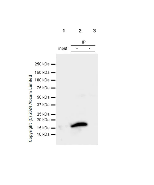 Immunoprecipitation - Anti-Fragilis antibody [RM1224] - BSA and Azide free (AB320854)