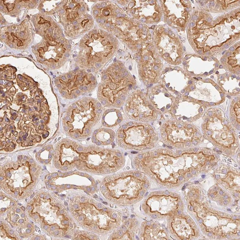Immunohistochemistry (Formalin/PFA-fixed paraffin-embedded sections) - Anti-FRAS1 antibody (AB251942)
