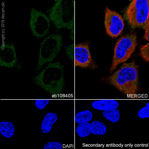 Immunocytochemistry/ Immunofluorescence - Anti-FRAT1 antibody [EPR3900] (AB108405)