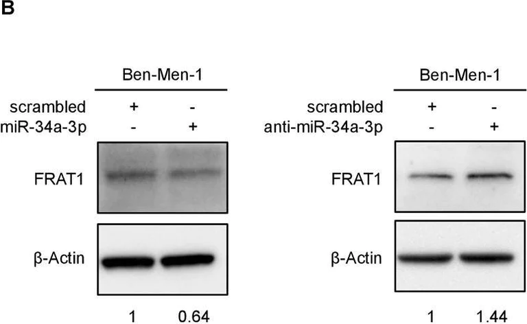 Western blot - Anti-FRAT1 antibody [EPR3900] (AB108405)