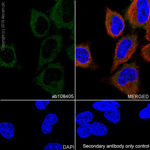 Immunocytochemistry/ Immunofluorescence - Anti-FRAT1 antibody [EPR3900] - BSA and Azide free (AB247658)