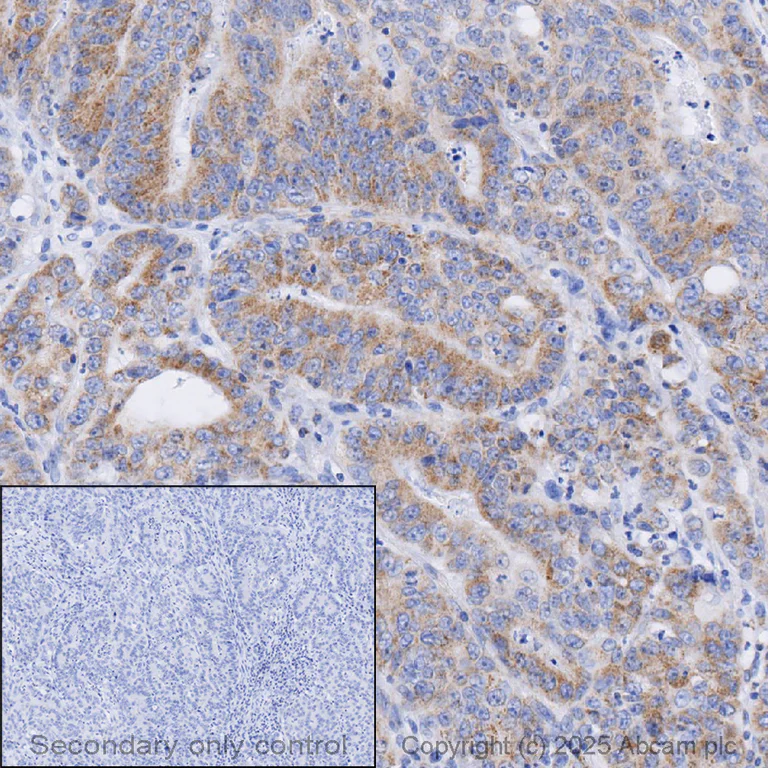 Immunohistochemistry (Formalin/PFA-fixed paraffin-embedded sections) - Anti-Frataxin antibody [18A5DB1] (AB110328)