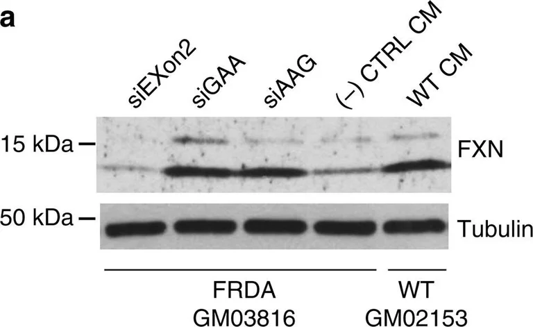 Western blot - Anti-Frataxin antibody [18A5DB1] (AB110328)