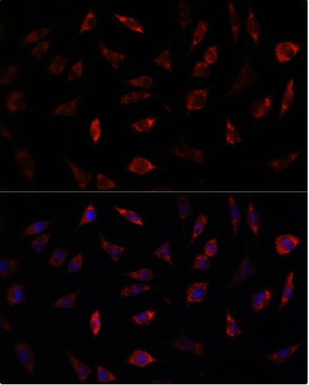 Immunocytochemistry/ Immunofluorescence - Anti-Frataxin antibody (AB175402), expandable thumbnail