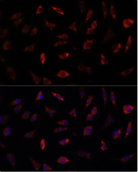 Immunocytochemistry/ Immunofluorescence - Anti-Frataxin antibody (AB175402)