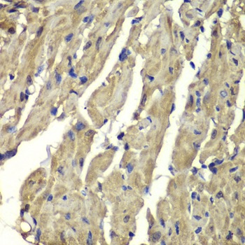 Immunohistochemistry (Formalin/PFA-fixed paraffin-embedded sections) - Anti-Frataxin antibody (AB175402), expandable thumbnail