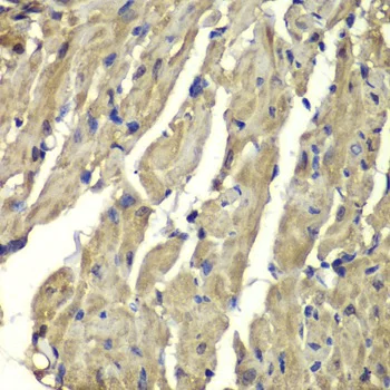 Immunohistochemistry (Formalin/PFA-fixed paraffin-embedded sections) - Anti-Frataxin antibody (AB175402)