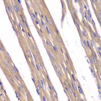 Immunohistochemistry (Formalin/PFA-fixed paraffin-embedded sections) - Anti-Frataxin antibody (AB175402), expandable thumbnail