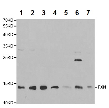 Western blot - Anti-Frataxin antibody (AB175402), expandable thumbnail