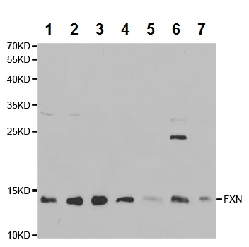Western blot - Anti-Frataxin antibody (AB175402)