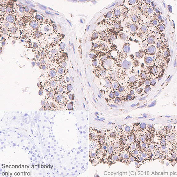 Immunohistochemistry (Formalin/PFA-fixed paraffin-embedded sections) - Anti-Frataxin antibody [EPR21840] (AB219414)