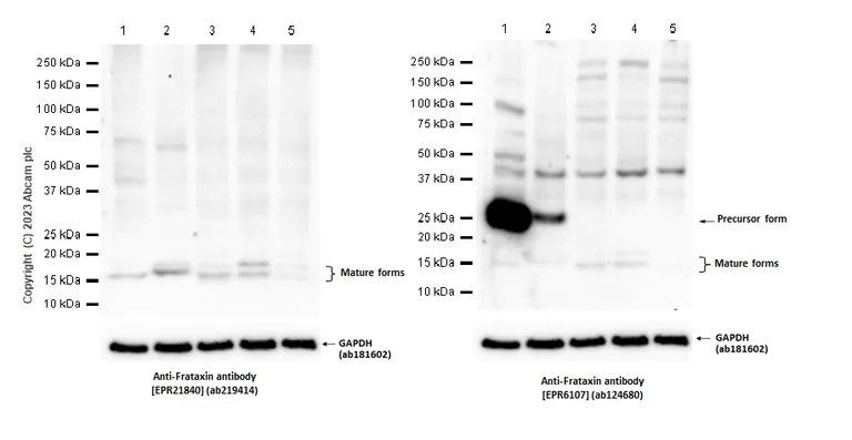 Western blot - Anti-Frataxin antibody [EPR21840] (AB219414)