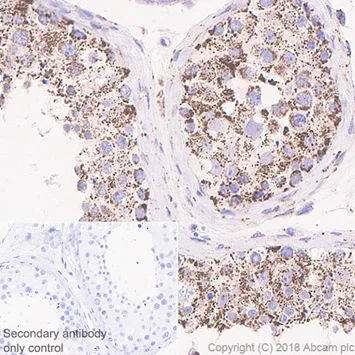 Immunohistochemistry (Formalin/PFA-fixed paraffin-embedded sections) - Anti-Frataxin antibody [EPR21840] - BSA and Azide free (AB236463)