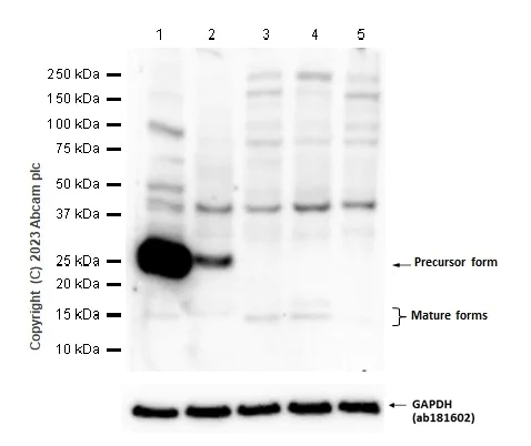 Western blot - Anti-Frataxin antibody [EPR6107] (AB124680)