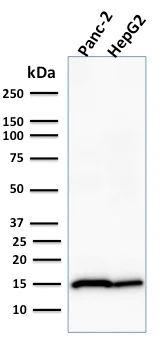 Western blot - Anti-Frataxin antibody [FXN/2124] (AB268063)