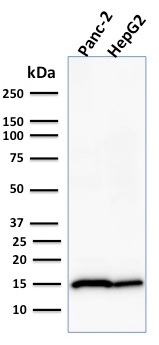 Western blot - Anti-Frataxin antibody [FXN/2124] - BSA and Azide free (AB268184), expandable thumbnail