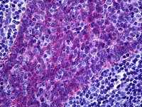 Immunohistochemistry (Formalin/PFA-fixed paraffin-embedded sections) - Anti-FREM1 antibody (AB117566)