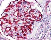 Immunohistochemistry (Formalin/PFA-fixed paraffin-embedded sections) - Anti-FREM2 antibody (AB117612)