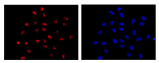 Immunocytochemistry/ Immunofluorescence - Anti-FRG1 antibody [EPR13098] (AB181083)