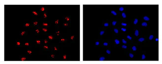 Immunocytochemistry/ Immunofluorescence - Anti-FRG1 antibody [EPR13098] - BSA and Azide free (AB250333)