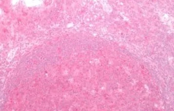 Immunohistochemistry (Formalin/PFA-fixed paraffin-embedded sections) - Anti-Frizzled 2/FZD2 antibody - Extracellular domain (AB219101)
