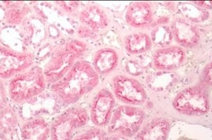 Immunohistochemistry (Formalin/PFA-fixed paraffin-embedded sections) - Anti-Frizzled 2/FZD2 antibody - Extracellular domain (AB219101)