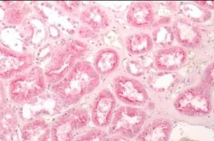Immunohistochemistry (Formalin/PFA-fixed paraffin-embedded sections) - Anti-Frizzled 2/FZD2 antibody - Extracellular domain (AB219101)