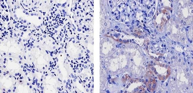 Immunohistochemistry (Formalin/PFA-fixed paraffin-embedded sections) - Anti-Frizzled 4 antibody [22HCLC] (AB277797)