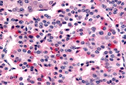Immunohistochemistry (Formalin/PFA-fixed paraffin-embedded sections) - Anti-Frizzled 5 antibody (AB115204), expandable thumbnail