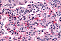 Immunohistochemistry (Formalin/PFA-fixed paraffin-embedded sections) - Anti-Frizzled 5 antibody (AB115204)