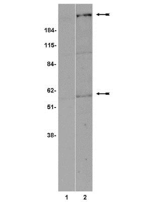 Western blot - Anti-Frizzled 5 antibody (AB14475)