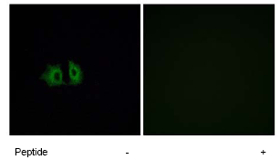 Immunocytochemistry/ Immunofluorescence - Anti-Frizzled 5 antibody (AB75234), expandable thumbnail