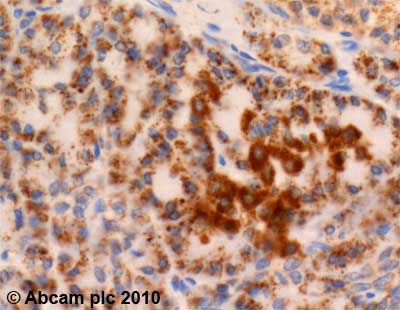 Immunohistochemistry (Formalin/PFA-fixed paraffin-embedded sections) - Anti-Frizzled 5 antibody (AB75234), expandable thumbnail
