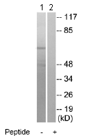 Western blot - Anti-Frizzled 5 antibody (AB75234), expandable thumbnail