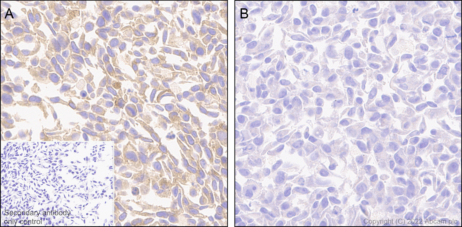 Immunohistochemistry (Formalin/PFA-fixed paraffin-embedded sections) - Anti-Frizzled 6 antibody [EPR25319-149] (AB290728)