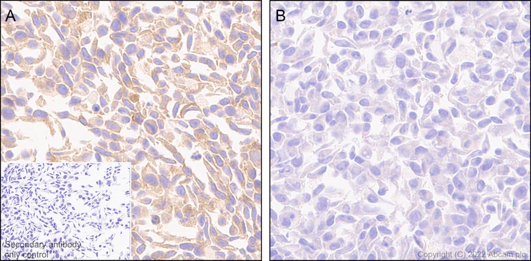 Immunohistochemistry (Formalin/PFA-fixed paraffin-embedded sections) - Anti-Frizzled 6 antibody [EPR25319-149] (BSA and Azide free) (AB290743)
