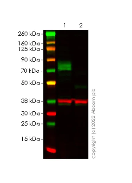 Western blot - Anti-Frizzled 6 antibody [EPR25319-149] (BSA and Azide free) (AB290743)