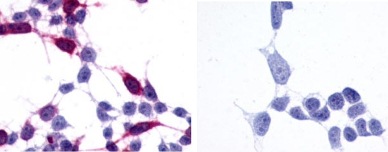 Immunocytochemistry - Anti-Frizzled 6 antibody - N-terminal (AB150545)