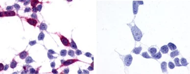 Immunocytochemistry - Anti-Frizzled 6 antibody - N-terminal (AB150545)