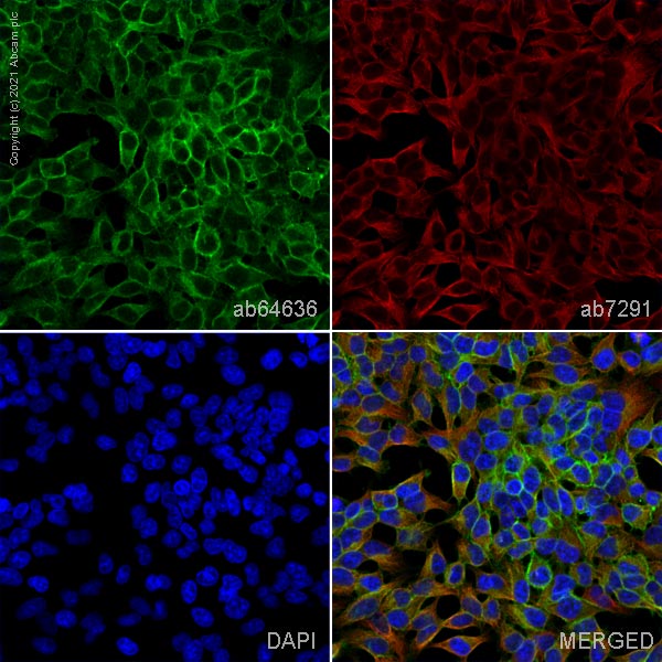 Immunocytochemistry/ Immunofluorescence - Anti-Frizzled 7 antibody (AB64636)