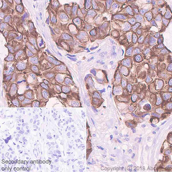 Immunohistochemistry (Formalin/PFA-fixed paraffin-embedded sections) - Anti-Frizzled 8 antibody [EPR7308(2)] (AB155093)