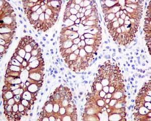 Immunohistochemistry (Formalin/PFA-fixed paraffin-embedded sections) - Anti-Frizzled 8 antibody [EPR7308(2)] (AB155093)
