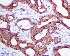 Immunohistochemistry (Formalin/PFA-fixed paraffin-embedded sections) - Anti-Frizzled 8 antibody [EPR7308(2)] (AB155093)