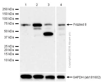 Western blot - Anti-Frizzled 8 antibody [EPR7308(2)] (AB155093)