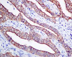 Immunohistochemistry (Formalin/PFA-fixed paraffin-embedded sections) - Anti-Frizzled 8 antibody [EPR7308(2)] - BSA and Azide free (AB238967)