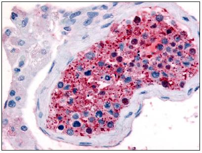 Immunohistochemistry (Formalin/PFA-fixed paraffin-embedded sections) - Anti-Frizzled 9 antibody (AB61430)