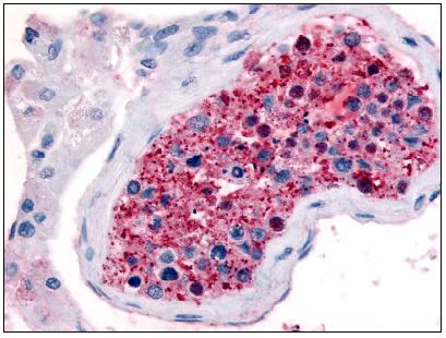 Immunohistochemistry (Formalin/PFA-fixed paraffin-embedded sections) - Anti-Frizzled 9 antibody (AB61430)