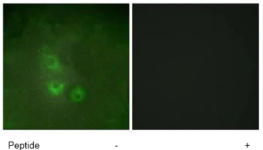 Immunocytochemistry/ Immunofluorescence - Anti-FRK antibody (AB64914)